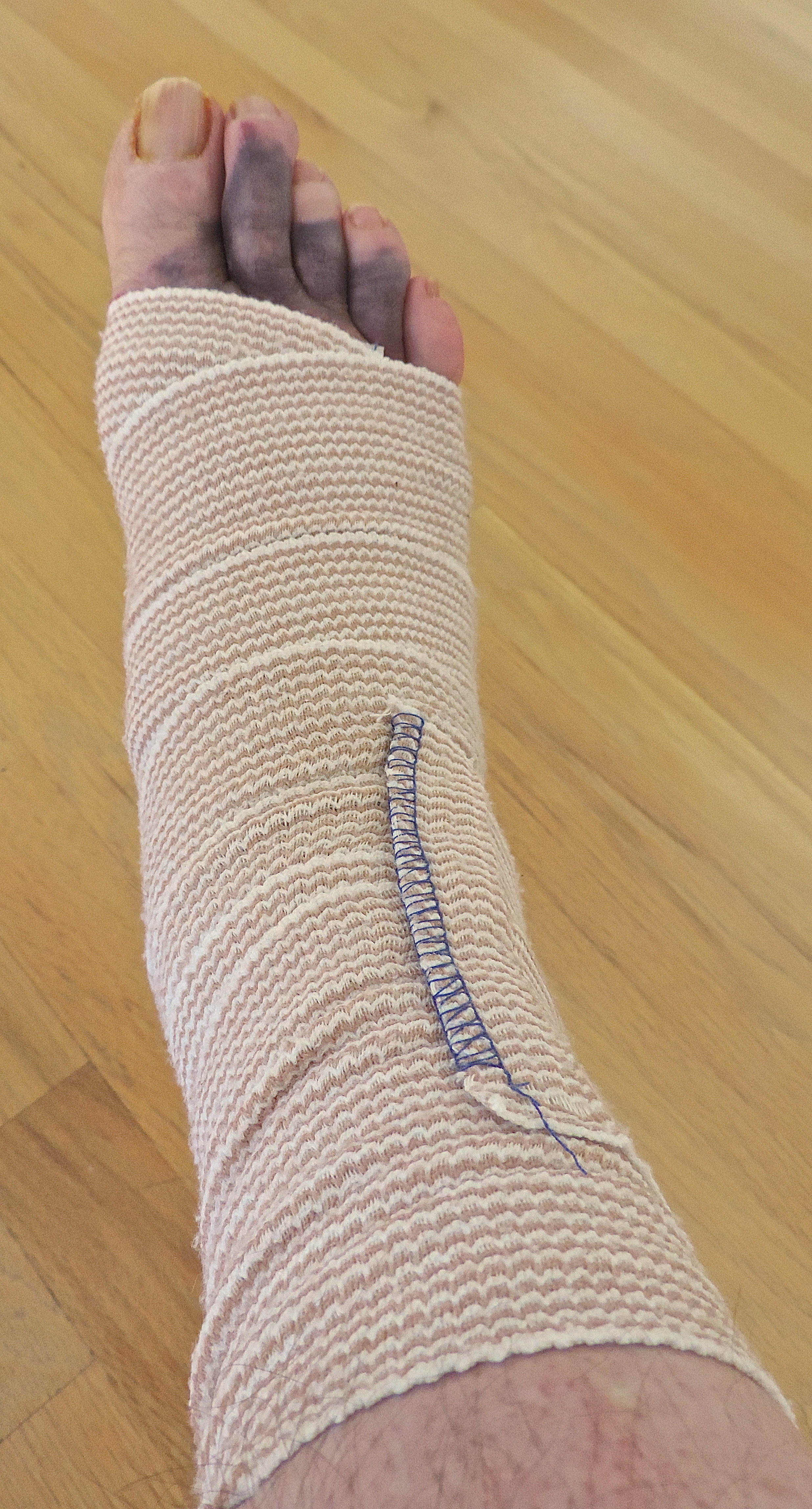 Image 1: <i>Tensor bandage</i>. Source: Flickr. Photo: P. Stevens.